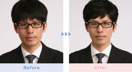 写真：before&after